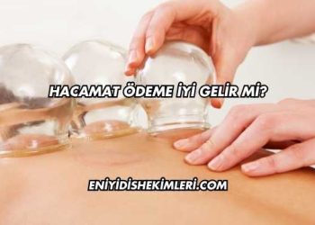 Hacamat Ödeme İyi Gelir mi?