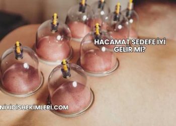 Hacamat Sedefe İyi Gelir mi?