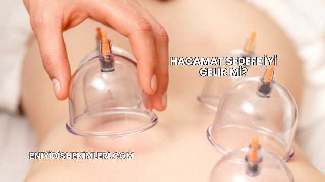 Hacamat Sedefe İyi Gelir mi?
