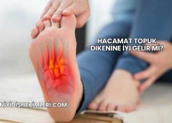 Hacamat Topuk Dikenine İyi Gelir mi?