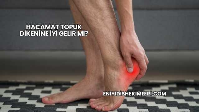 Hacamat Topuk Dikenine İyi Gelir mi?