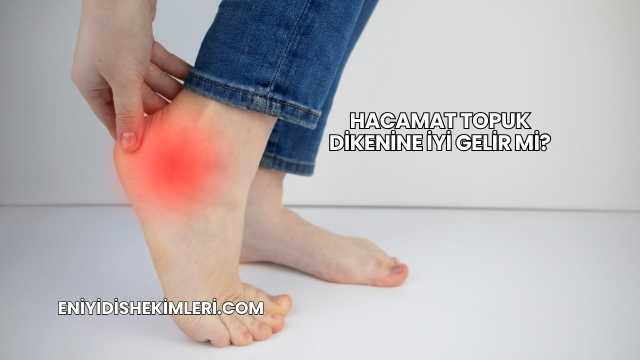 Hacamat Topuk Dikenine İyi Gelir mi?
