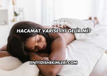 Hacamat Varise İyi Gelir mi?