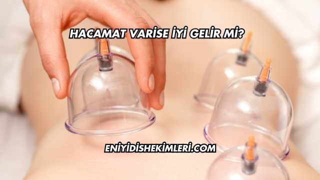 Hacamat Varise İyi Gelir mi?
