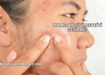 Hametan Sivilceye İyi Gelir mi?