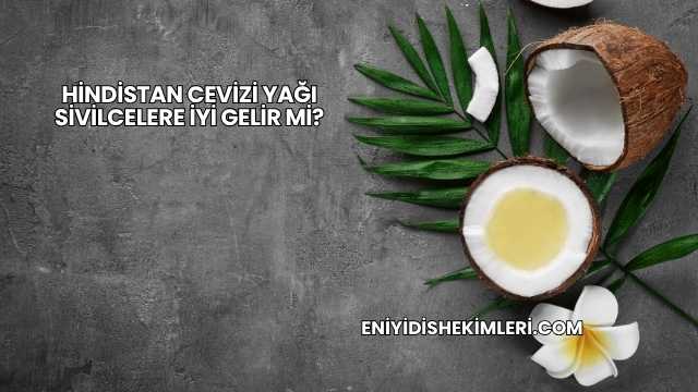 Hindistan Cevizi Yağı Sivilcelere İyi Gelir mi?