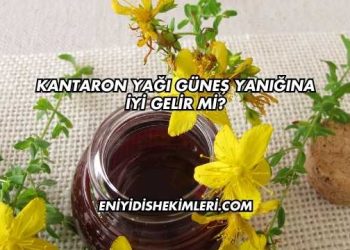 Kantaron Yağı Güneş Yanığına İyi Gelir mi?