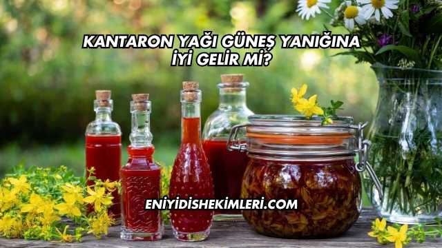 Kantaron Yağı Güneş Yanığına İyi Gelir mi?