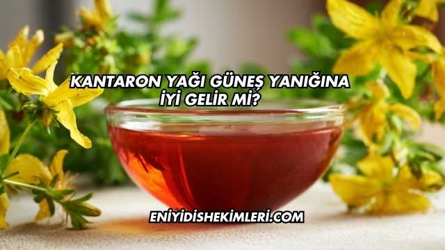 Kantaron Yağı Güneş Yanığına İyi Gelir mi?