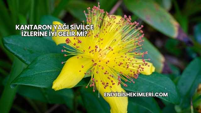 Kantaron Yağı Sivilce İzlerine İyi Gelir mi?