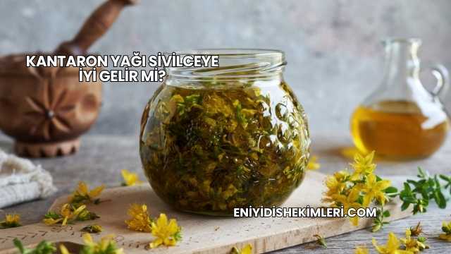 Kantaron Yağı Sivilceye İyi Gelir mi?
