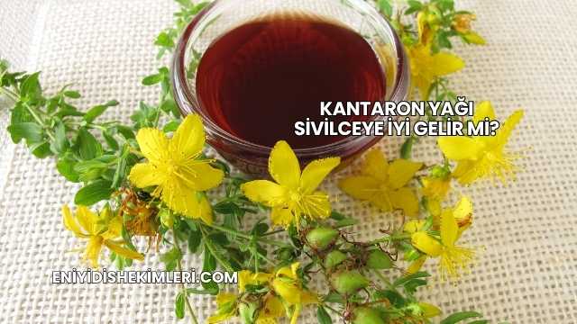 Kantaron Yağı Sivilceye İyi Gelir mi?