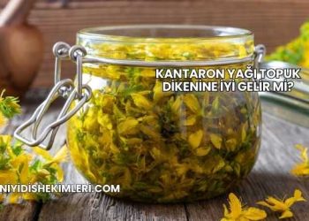 Kantaron Yağı Topuk Dikenine İyi Gelir mi?