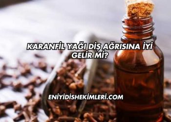Karanfil Yağı Diş Ağrısına İyi Gelir mi?