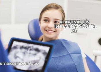 Klavunat Diş İltihabına İyi Gelir mi?