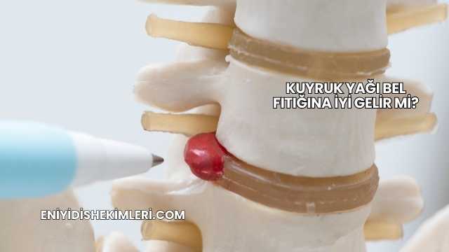 Kuyruk Yağı Bel Fıtığına İyi Gelir mi?