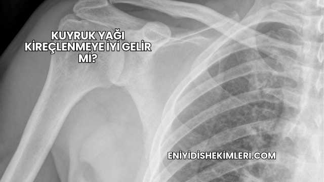 Kuyruk Yağı Kireçlenmeye İyi Gelir mi?