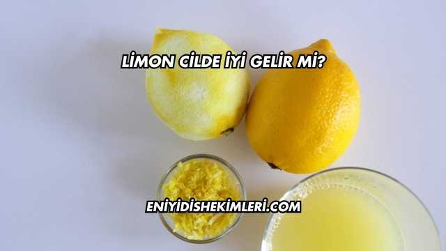 Limon Cilde İyi Gelir mi?