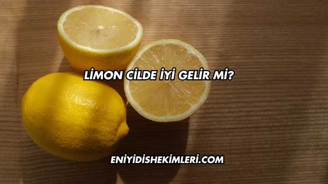 Limon Cilde İyi Gelir mi?