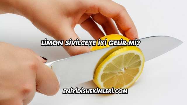 Limon Sivilceye İyi Gelir mi?