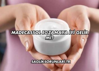 Madecassol Egzamaya İyi Gelir mi?