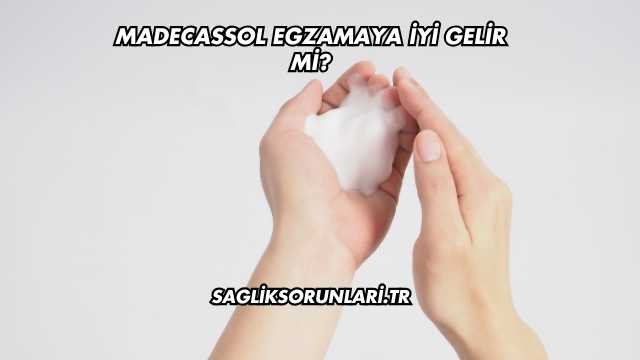 Madecassol Egzamaya İyi Gelir mi?