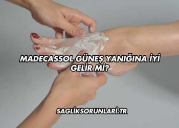 Madecassol Güneş Yanığına İyi Gelir mi?