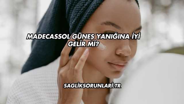 Madecassol Güneş Yanığına İyi Gelir mi?