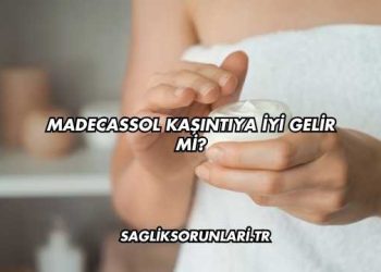 Madecassol Kaşıntıya İyi Gelir mi?