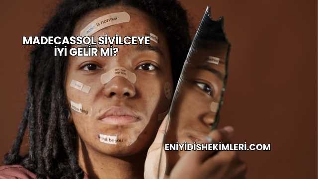 Madecassol Sivilceye İyi Gelir mi?
