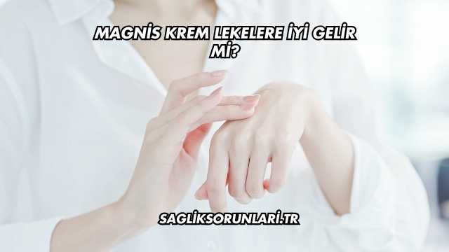 Magnis Krem Lekelere İyi Gelir mi?