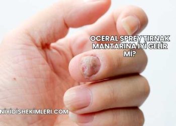 Oceral Sprey Tırnak Mantarına İyi Gelir mi?