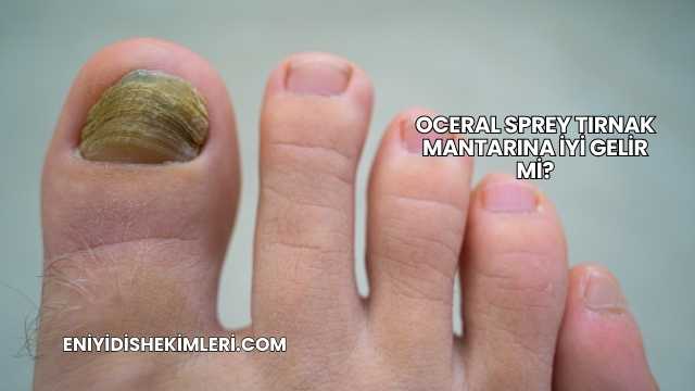 Oceral Sprey Tırnak Mantarına İyi Gelir mi?
