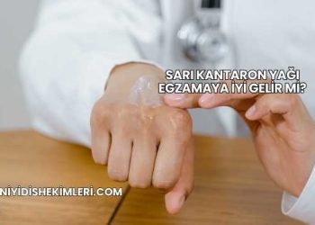 Sarı Kantaron Yağı Egzamaya İyi Gelir mi?