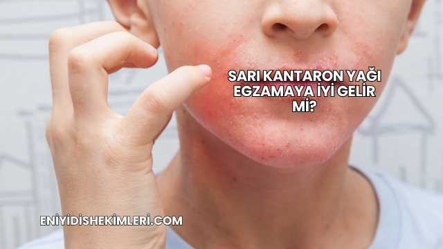 Sarı Kantaron Yağı Egzamaya İyi Gelir mi?