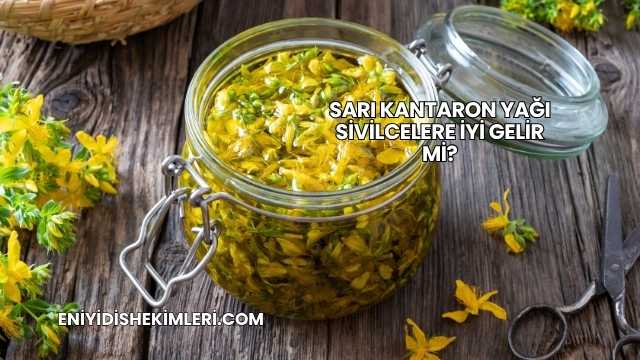Sarı Kantaron Yağı Sivilcelere İyi Gelir mi?