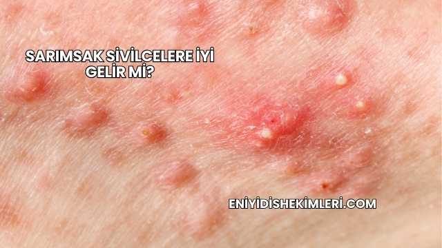 Sarımsak Sivilcelere İyi Gelir mi?