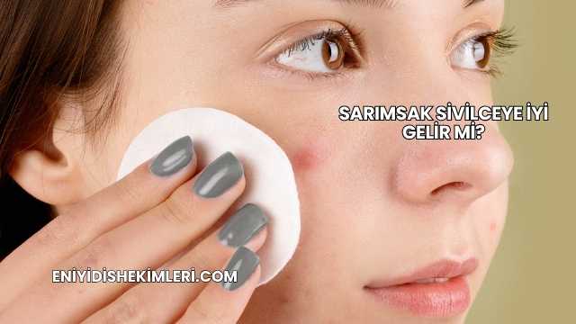 Sarımsak Sivilceye İyi Gelir mi?