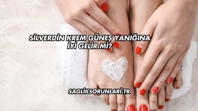 Silverdin Krem Güneş Yanığına İyi Gelir mi?