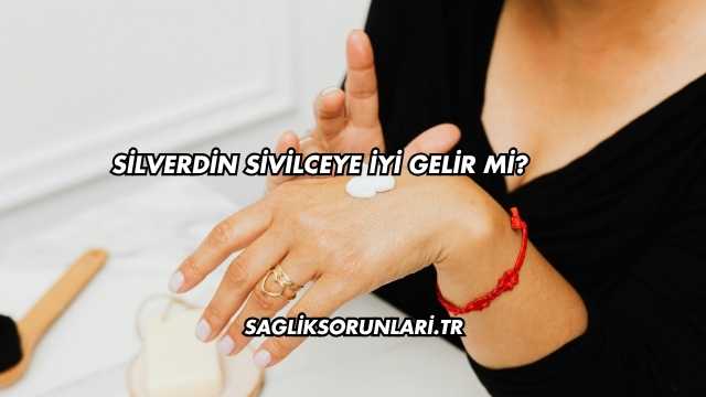 Silverdin Sivilceye İyi Gelir mi?