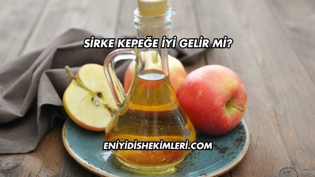 Sirke Kepeğe İyi Gelir mi?