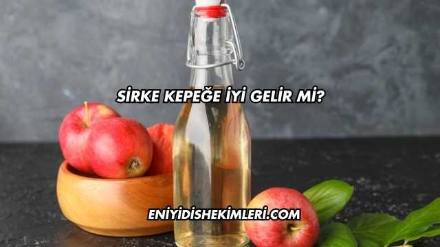 Sirke Kepeğe İyi Gelir mi?