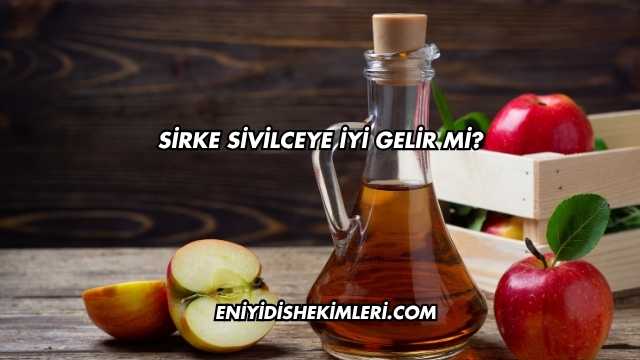 Sirke Sivilceye İyi Gelir mi?