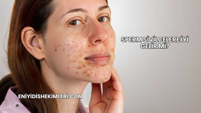 Sperm Sivilcelere İyi Gelir mi?