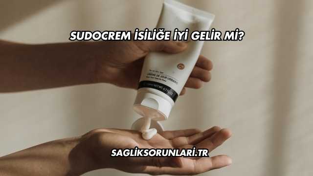 Sudocrem İsiliğe İyi Gelir mi?