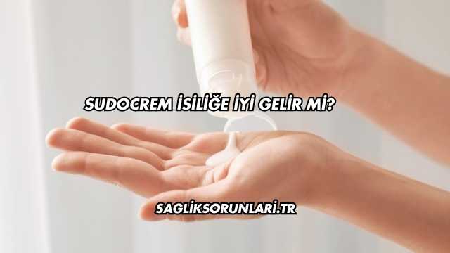 Sudocrem İsiliğe İyi Gelir mi?