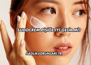 Sudocrem Pişiğe İyi Gelir mi?