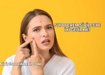 Sudocrem Sivilceye İyi Gelir mi?