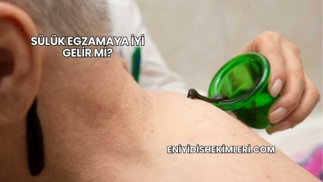 Sülük Egzamaya İyi Gelir mi?