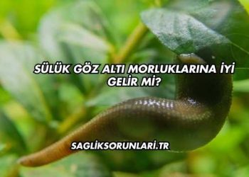 Sülük Göz Altı Morluklarına İyi Gelir mi?